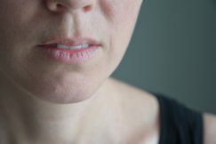 Pękające kąciki ust - co oznaczają i jak uporać się z tym niewygodnym problemem?