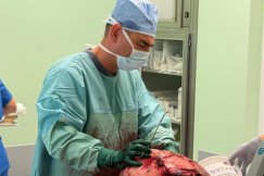 Inni rozkładali ręce, zespół profesora dał jej nadzieję. Gigantyczny guz usunięty w bielskim szpitalu [+18]
