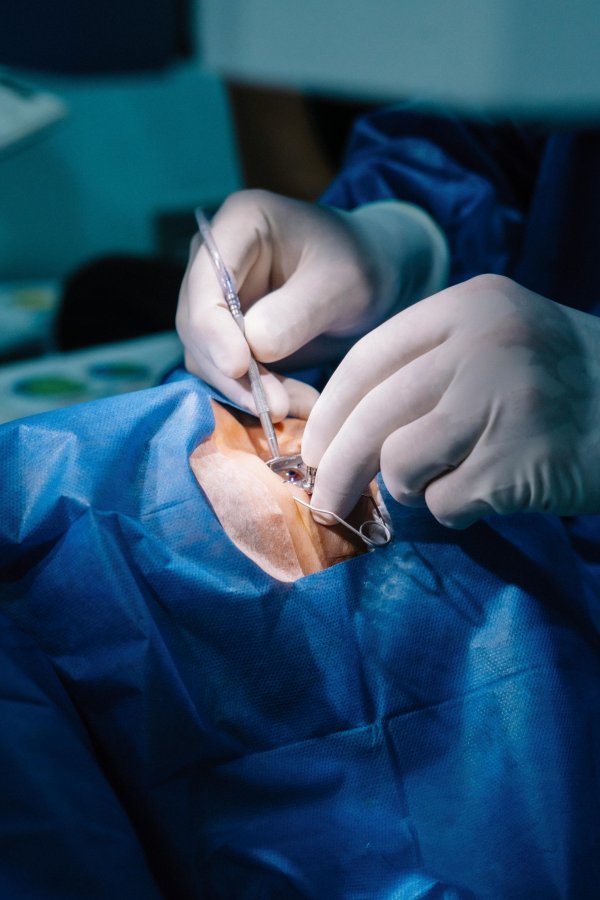 Operacja zaćmy – grupy ryzyka, objawy zaćmy i przebieg zabiegu