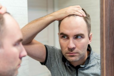 Zakola, łysienie i samoocena. Dlaczego dla wielu mężczyzn to coś więcej niż kwestia fryzury?