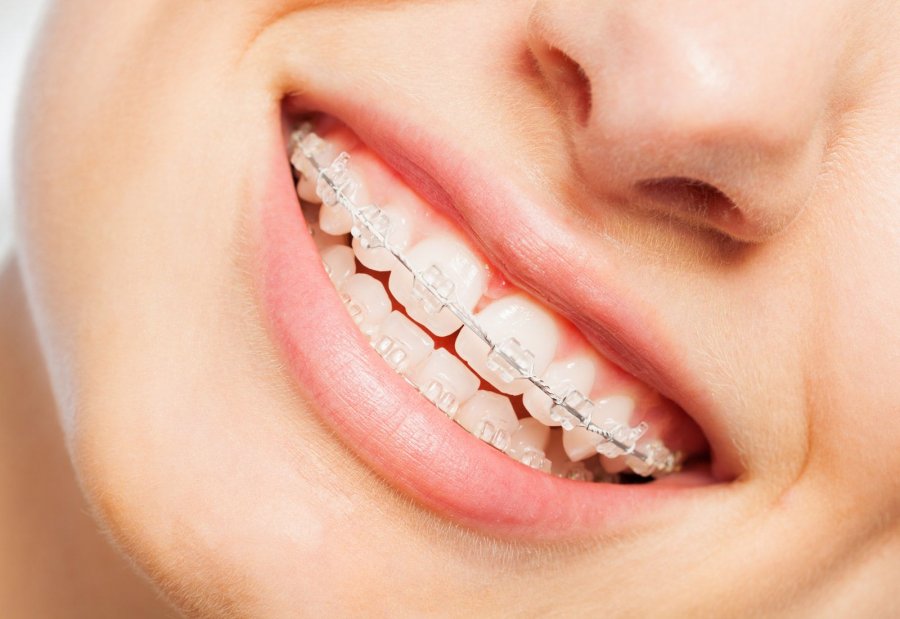 Czym zajmuje się ortodonta?