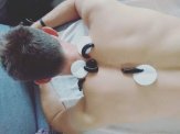 Hirudoterapia - pijawki -medycyna naturalna