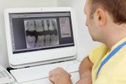 LEKARZ STOMATOLOG - DENTYSTA