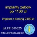 Implanty zębów 1100 zł